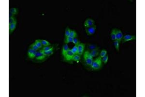 Immunofluorescent analysis of PC-3 cells using ABIN7154676 at dilution of 1:100 and Alexa Fluor 488-congugated AffiniPure Goat Anti-Rabbit IgG(H+L) (GNG5 antibody  (AA 2-65))