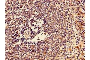 Immunohistochemistry of paraffin-embedded human spleen tissue using ABIN7147027 at dilution of 1:100 (Cathepsin Z antibody  (AA 127-287))