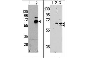 Image no. 2 for anti-Ribosomal Protein S6 Kinase, 70kDa, Polypeptide 1 (RPS6KB1) (Ser424) antibody (ABIN5552136) (RPS6KB1 antibody  (Ser424))