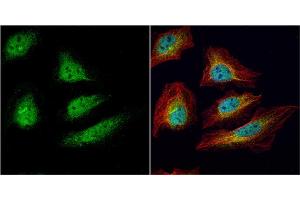 ICC/IF Image CDC34 antibody [N1C3] detects CDC34 protein at cytoplasm and nucleus by immunofluorescent analysis. (CDC34 antibody)