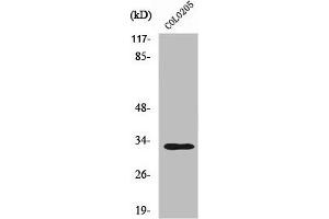 Western Blot analysis of COLO205 cells using UBCE7IP4 Polyclonal Antibody (RNF144A antibody  (Internal Region))