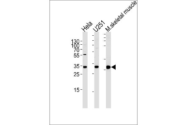 POLR2C anticorps  (C-Term)