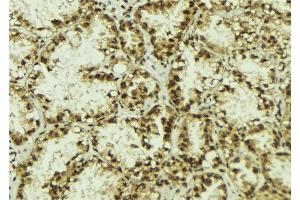 ABIN6273081 at 1/100 staining Human lung tissue by IHC-P. (TLE3 antibody  (Internal Region))