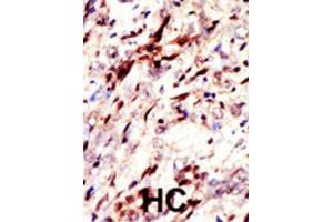 Immunohistochemistry (IHC) image for anti-SUMO (pan) antibody (ABIN2997018) (SUMO antibody  (pan))