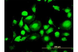 Immunofluorescence of monoclonal antibody to MAPK1 on HeLa cell. (ERK2 antibody  (AA 261-360))