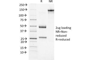 SDS-PAGE Analysis Purified BRCA1 Mouse Monoclonal Antibody (BRCA1/1472). (BRCA1 antibody  (AA 445-620))