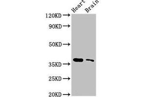 Western Blot Positive WB detected in: Mouse heart tissue, Mouse brain tissue All lanes: SRR antibody at 3 μg/mL Secondary Goat polyclonal to rabbit IgG at 1/50000 dilution Predicted band size: 37 kDa Observed band size: 37 kDa (SRR antibody  (AA 1-340))