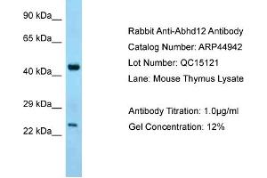 WB Suggested Anti-Abhd12 Antibody   Titration: 1. (ABHD12 antibody  (C-Term))