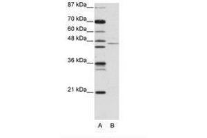 Image no. 1 for anti-Tripartite Motif Containing 14 (TRIM14) (AA 116-165) antibody (ABIN203143) (TRIM14 antibody  (AA 116-165))
