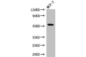 Western Blot Positive WB detected in: MCF-7 whole cell lysate All lanes: PSEN1 antibody at 3 μg/mL Secondary Goat polyclonal to rabbit IgG at 1/50000 dilution Predicted band size: 53, 43, 22, 47, 49 kDa Observed band size: 53 kDa (Presenilin 1 antibody  (AA 4-218))