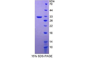Image no. 1 for Regulator of G-Protein Signalling 19 (RGS19) (AA 1-217) protein (His tag) (ABIN4991042)