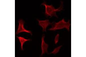 ABIN6275926 staining COLO205 by IF/ICC. (CRHR2 antibody  (Internal Region))
