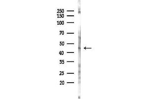anti-ELK1, Member of ETS Oncogene Family (ELK1) (C-Term) antibody