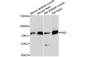 Western blot analysis of extracts of various cell lines, using SKIL antibody (ABIN6292273) at 1:3000 dilution. (SKIL antibody)