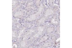 Immunohistochemical staining of human kidney with C10orf35 polyclonal antibody  shows distinct membranous positivity in subsets of glomerular cells at 1:500-1:1000 dilution. (C10ORF35 antibody)