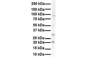 WB Suggested Anti-KRAS antibody Titration: 1 ug/mL Sample Type: Human RPMI-8226 (K-RAS antibody  (N-Term))