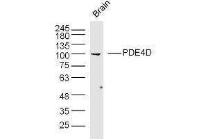 Mouse brain lysates probed with PDE4D Polyclonal Antibody, unconjugated  at 1:300 overnight at 4°C followed by a conjugated secondary antibody at 1:10000 for 90 minutes at 37°C.