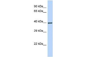 Host:  Rabbit  Target Name:  ZNF607  Sample Type:  Jurkat Whole Cell lysates  Antibody Dilution:  1.
