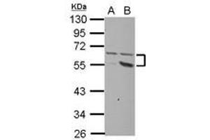 Image no. 1 for anti-Plexin Domain Containing 2 (PLXDC2) (AA 1-218) antibody (ABIN1500293) (PLXDC2 antibody  (AA 1-218))