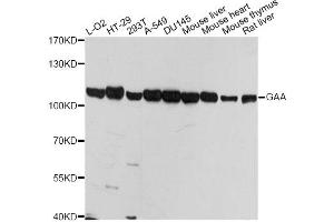Western blot analysis of extracts of various cell lines, using GAA antibody (ABIN5974462) at 1/1000 dilution. (GAA antibody)