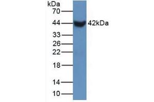 Figure. (SFTPB antibody  (AA 20-193))