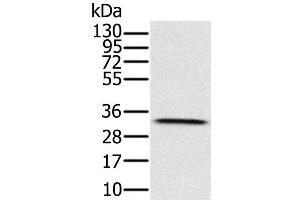 Western Blot analysis of Human testis tissue using HSD17B8 Polyclonal Antibody at dilution of 1:650