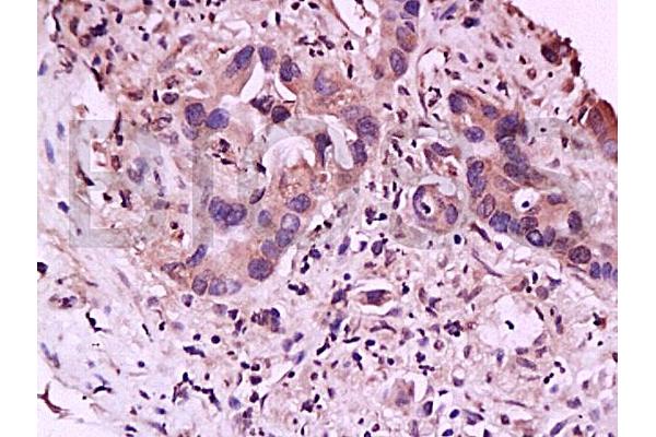 IL23R antibody  (AA 401-550)