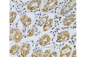 Immunohistochemistry of paraffin-embedded Human stomach using SERPINB5 Polyclonal Antibody at dilution of 1:200 (40x lens). (SERPINB5 antibody)