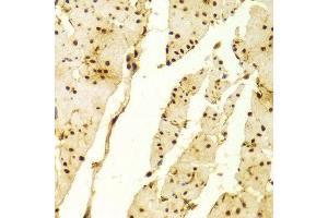 Immunohistochemistry of paraffin-embedded Human esophageal using MSH2 antibody at dilution of 1:100 (x400 lens). (MSH2 antibody  (AA 1-300))