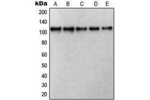 Western blot analysis of RB1 expression in Jurkat (A), COLO205 (B), HuvEc (C), A431 (D), NIH3T3 (E) whole cell lysates. (Retinoblastoma 1 antibody  (C-Term))