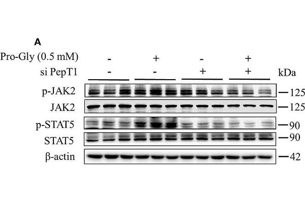 JAK2 抗体  (pTyr1007, pTyr1008)