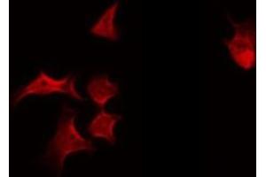 ABIN6269225 staining HeLa by IF/ICC. (alpha Adducin antibody)