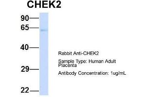 Host:  Rabbit  Target Name:  CHEK2  Sample Type:  Human Adult Placenta  Antibody Dilution:  1. (CHEK2 antibody  (N-Term))