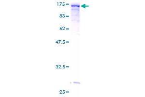 Vinculin Protein (VCL) (AA 1-1066) (GST tag)