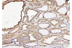 IHC analysis of CALR using anti-CALR antibody (ABIN7600329).