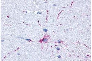 Immunohistochemical (Formalin/PFA-fixed paraffin-embedded sections) staining in human brain, neurons and glia with GRM8 polyclonal antibody . (GRM8 antibody  (C-Term))