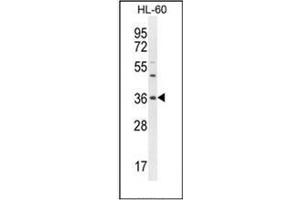 Western blot analysis of OR1J4 Antibody (C-term) in HL-60 cell line lysates (35ug/lane). (OR1J4 antibody  (C-Term))