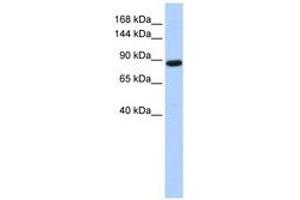 Image no. 1 for anti-HECT Domain and Ankyrin Repeat Containing, E3 Ubiquitin Protein Ligase 1 (HACE1) (AA 792-841) antibody (ABIN6740811) (HACE1 antibody  (AA 792-841))