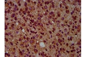 IHC image of ABIN7154699 diluted at 1:500 and staining in paraffin-embedded human glioma performed on a Leica BondTM system. (GNAL antibody  (AA 4-116))
