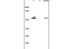 Lane 1: mouse brain lysates Lane 2: mouse intestine lysates probed with Anti Matrilin 1 Polyclonal Antibody, Unconjugated (ABIN676178) at 1:200 in 4C.