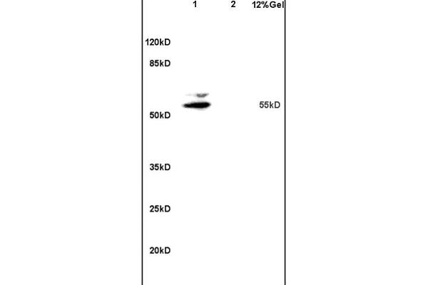 MATN1 抗体  (AA 301-400)