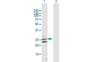 Western Blot analysis of CLCF1 expression in transfected 293T cell line by CLCF1 MaxPab polyclonal antibody. (CLCF1 antibody  (AA 1-225))