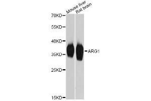 Western blot analysis of extracts of various cell lines, using ARG1 Antibody. (Liver Arginase antibody  (AA 1-322))