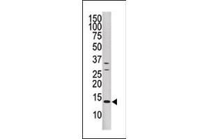 DUSP15 antibody  (N-Term)