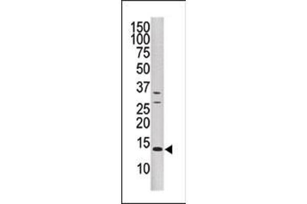 DUSP15 antibody  (N-Term)
