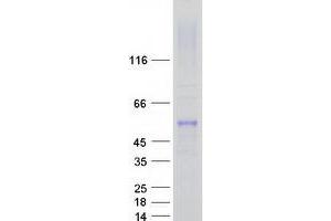 Validation with Western Blot (Fascin Protein (FSCN1) (Myc-DYKDDDDK Tag))