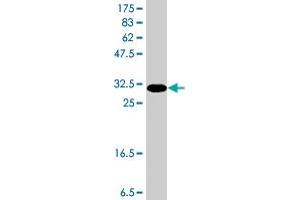 Western Blot detection against Immunogen (37. (NELL1 antibody  (AA 304-403))