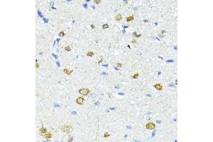 Immunohistochemistry of paraffin-embedded Rat brain using Nestin antibody (ABIN6128335, ABIN6144536, ABIN6144537 and ABIN6215496) at dilution of 100 (40x lens). (Nestin antibody  (AA 1392-1621))