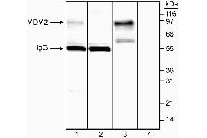 Immunoprecipitation/western blot analysis of MDM2. (MDM2 antibody  (AA 154-167))
