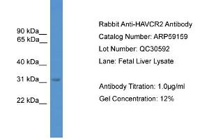 Western Blotting (WB) image for anti-Hepatitis A Virus Cellular Receptor 2 (TIM 3) (C-Term) antibody (ABIN2787957)